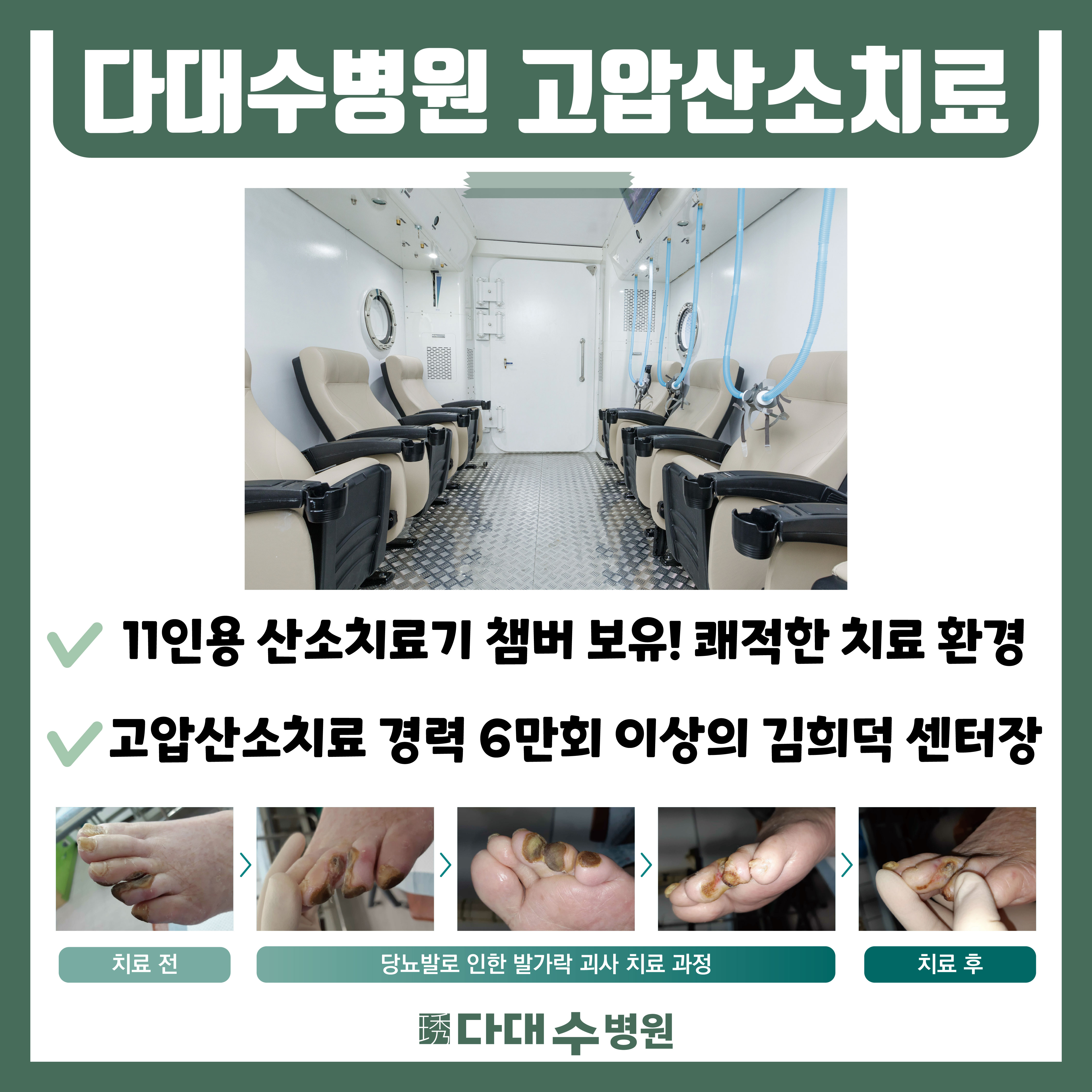 첨부파일